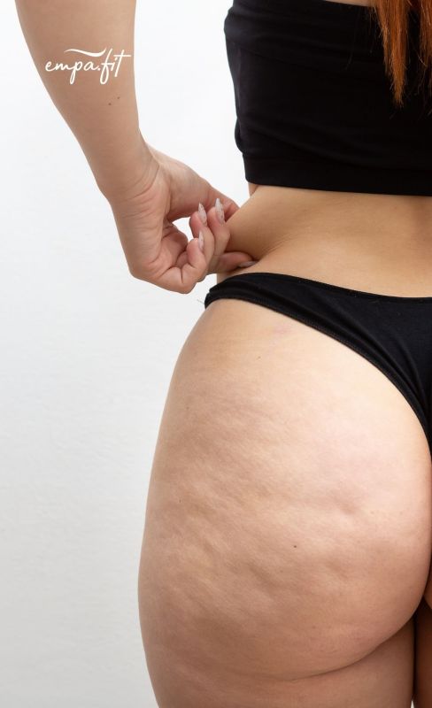Die innovative Technologie von ‚Abnehmen im Liegen‘ kann dazu beitragen, das Hautbild zu glätten und die sichtbare Erscheinung von Cellulite zu verbessern. Sie unterstützt das allgemeine Hautbild und die optische Wirkung von Cellulite.